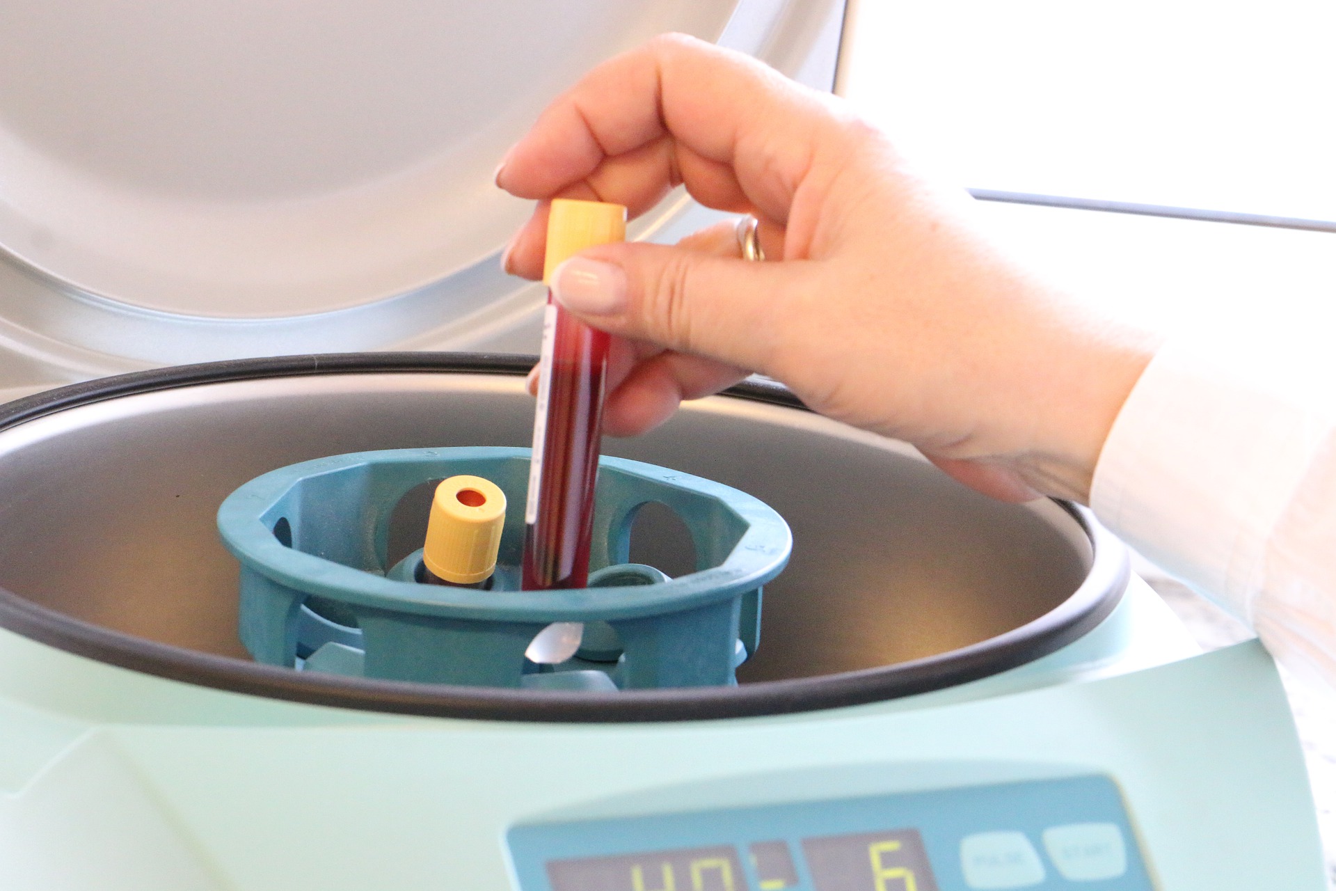 Una mano introduce una muestra de sangre en una centrifugadora para poder obtener plasma